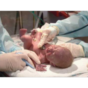 Neonatal- Nursing CE's