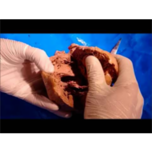 Heart Dissection and Clinical Correlations - Dr. Sanjoy Sanyal icon