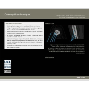 Ostéomyélites chroniques