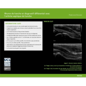 Rhume de hanche et diagnostif différentiel avec l’arthrite septique de hanche icon