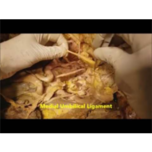 Pelvic Narrative Surgical Dissection - Iliac Artery Branches - Sanjoy Sanyal icon