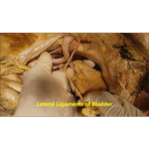 Urinary Bladder-UV Junction-Trigone-Ductus Deferens Narrative Dissection - Sanjoy Sanyal