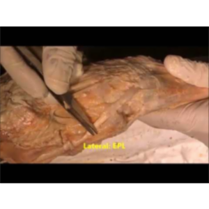 Forearm Extensor-Anatomical Snuffbox-Hand Dissection - Sanjoy Sanyal icon