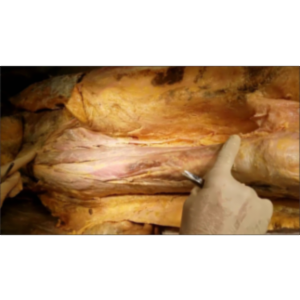 Thigh Anterior-Femoral Triangle-Adductor Canal Surgical Dissection With Clinical Aspects - Sanjoy Sany icon