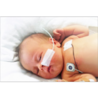 Caring For Babies With Neonatal Abstinence Syndrome (NAS)