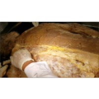 Erector Spinae of Homo Erectus and Accessory Respiratory Muscles -Sanjoy Sanyal