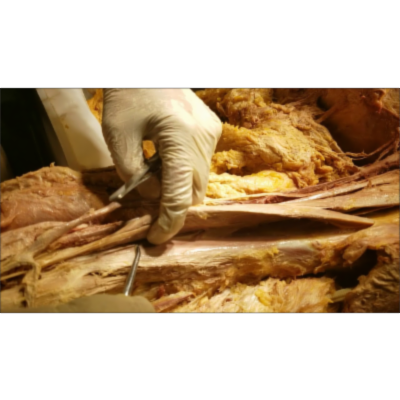 Arm Flexor Muscles Narrative Dissection-Sanjoy Sanyal icon