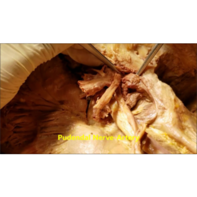 Gluteal-Pudendal Nerves-Vessels And Gluteal Paralysis Description-Sanjoy Sanyal icon