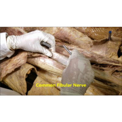 Thigh Hamstring Compartment Muscles Dissection-Popliteal Artery Entrapment - Sanjoy Sanyal icon