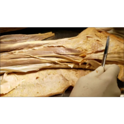 Leg Lateral-Anterior Foot Dorsal Compartment Muscles-DANCER'S FRACTURE - Sanjoy Sanyal