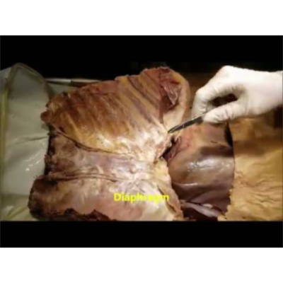 Thoracic Wall [Rib-Cage] Disengaged-Functional Musculo-Skeletal Components-Part 1 - Sanjoy Sanyal