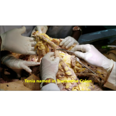 Large Intestine Dissection - External and Internal Clinical Morphology – Sanjoy Sanyal icon