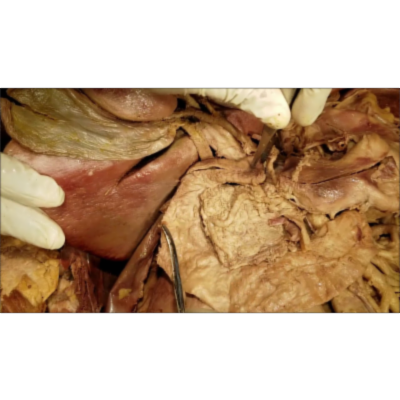 Detailed Biliary System Surgical Dissection with Exhaustive Clinical Narration – Sanjoy Sanyal icon