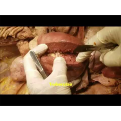 Splenic Dissection in Real-Time and Clinico-Surgical Aspects Narration – Sanjoy Sanyal icon