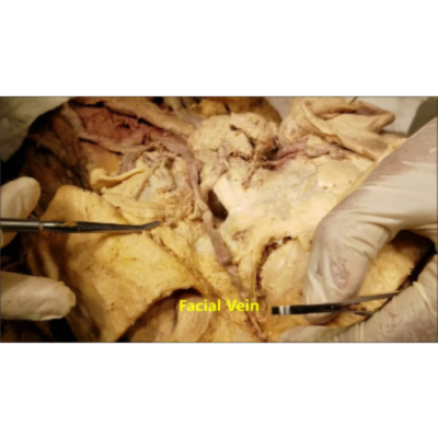 Meticulous Lymphovascular Demonstration of Face and Neck with Clinical Narration – Sanjoy Sanyal icon