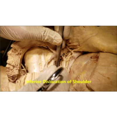 Musculocutaneous Axillary and Radial Nerve Full Course - Sanjoy Sanyal icon