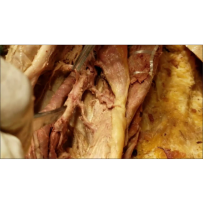 Popliteal Fossa Boundaries Contents and Clinical Aspects – Sanjoy Sanyal icon