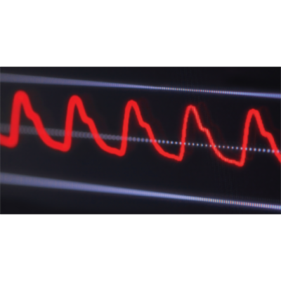 Using Six Sigma DMAIC Methodology and Discrete Event Simulation to Reduce Patient Discharge Time in King Hussein Cancer Center icon