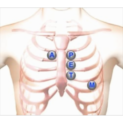 Heart Murmur | Lesson | Heart Sounds icon