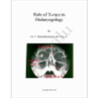 Role of xrays in otolaryngology icon