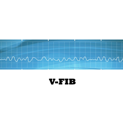 If EKG Rhythms Were Songs icon