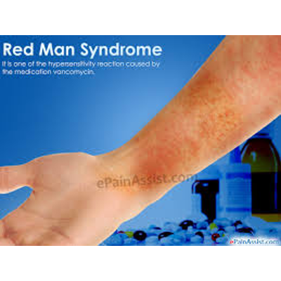 Red man syndrome
