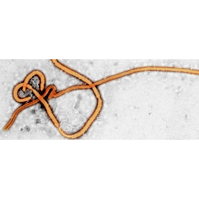 New Ebola Outbreak Suggests The Virus Might Lurk For Years Inside People icon