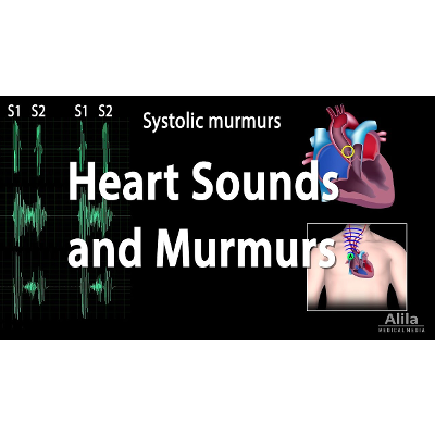 Heart Sounds and Heart Murmurs, Animation. icon