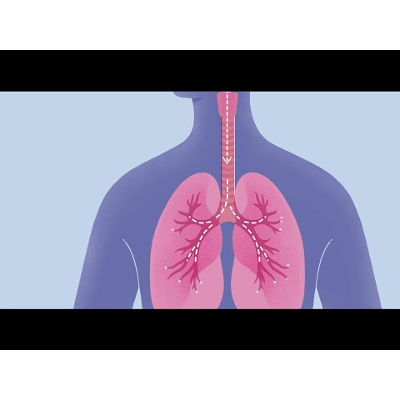 How COVID-19 Affects Your Lungs icon