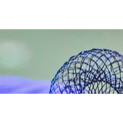 A new way to heal hearts without surgery icon