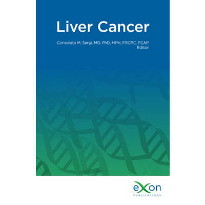 Liver Cancer icon