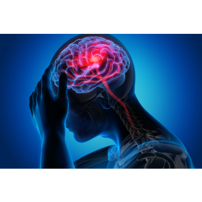 Modules for Stroke Nurses