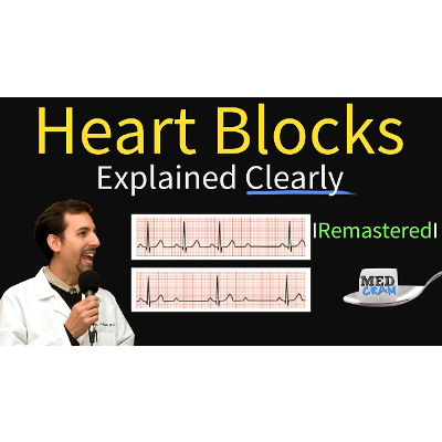 Heart Blocks Explained - First, Second, Third Degree and Bundle Branch on ECG icon