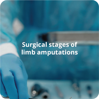 Surgical stages of limb amputations icon
