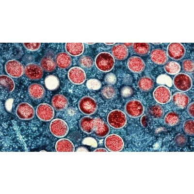 WHO changes monkeypox variant names. The name is set to change next icon