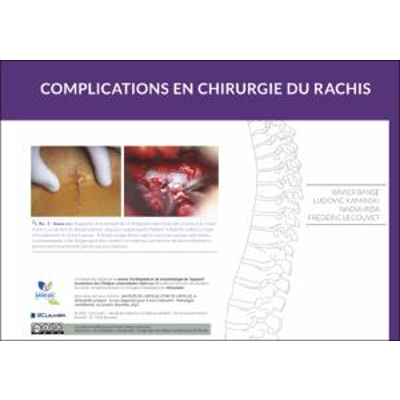 Complications en chirurgie du rachis icon