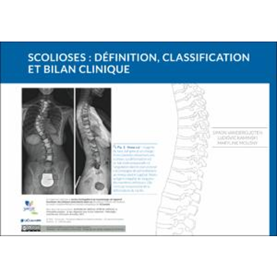 Scolioses : définition, classification et bilan clinique icon