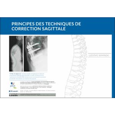 Principes des techniques de correction sagittale icon
