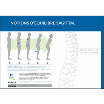 Notions d’équilibre sagittal icon