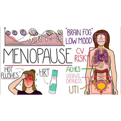 Menopause Explained Clearly (Includes HRT &amp; Perimenopause)
