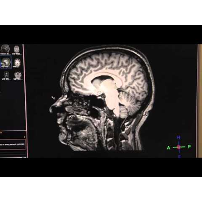 PTSD Documentary icon