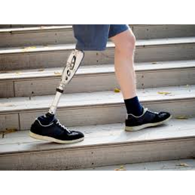 Prosthesis: MedlinePlus Medical Encyclopedia icon