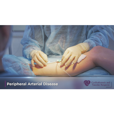 Limb Preservation and Amputation Prevention | Peripheral Arterial Disease | CTVS Texas