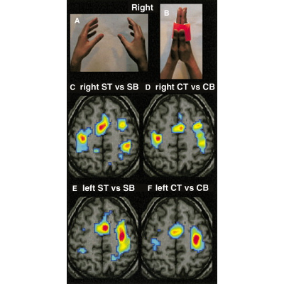 I Feel My Hand Moving - A New Role of the Primary Motor Cortex in Somatic Perception of Limb Movement icon