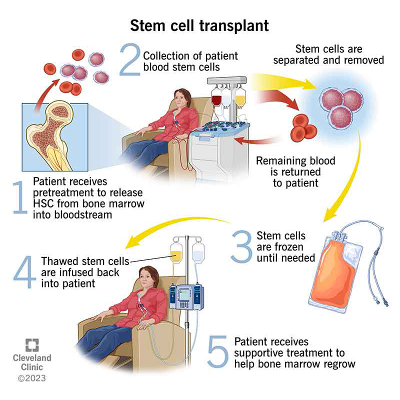 Stem Cell (Bone Marrow) Transplant icon