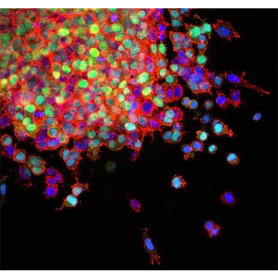 DCB - Tumor Metastasis Research icon