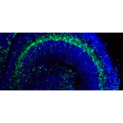 Brain Organoids Power New Wave of Computer Science Innovation - Research Horizons icon