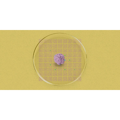 Human brain cells hooked up to a chip can do speech recognition icon