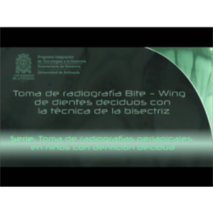 Toma de radiografía Bite - Wing de dientes deciduos con la técnica de la bisectriz icon