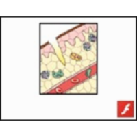 Nonspecific Inflammatory Response icon